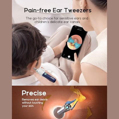 Bebird EarSight Plus | Ear Wax Removal Tool with Camera - I35R